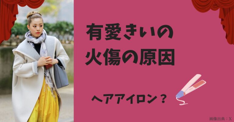 有愛きいの火傷の原因はなに?いじめの噂や天彩峰里・文春の記事に関するSNSの反応を調査! | ドラマ好きのドラマ考察