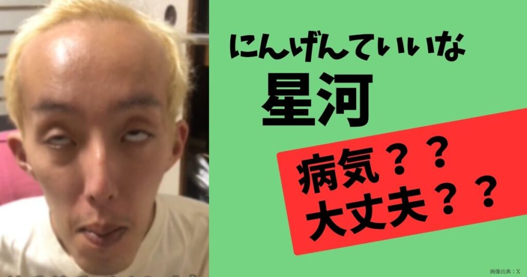 星河は病気で瘦せすぎ？のトップ画像